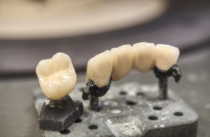 Porcelain Veneers in HSR Layout