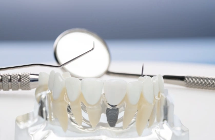Dental Crowns in Varthur