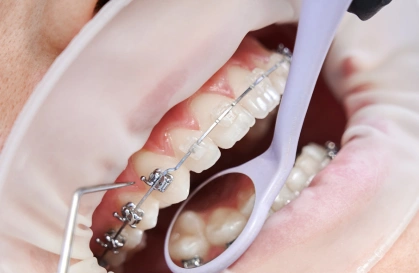 Orthodontics